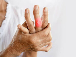 Amla beneficial in arthritis pain